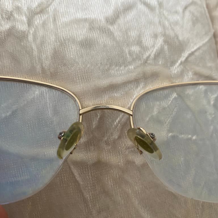 Osse Gözlüğüm Kısa Sürede Soyulup Grileşti, Mağaza Çözüm Sunmadı