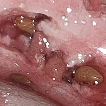 Eti Puf’ta Solucan Benzeri Canlı Bulundu, Ambalaj Sorunu Ve Sağlık Endişesi