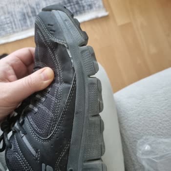 Skechers Ayakkabısında Açılma Problemi Ve Kullanıcı Hatası İddiası