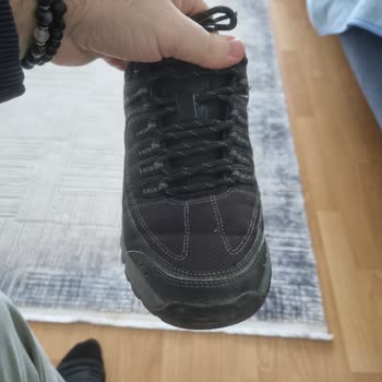 Skechers Ayakkabısında Açılma Problemi Ve Kullanıcı Hatası İddiası