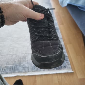 Skechers Ayakkabısında Açılma Problemi Ve Kullanıcı Hatası İddiası