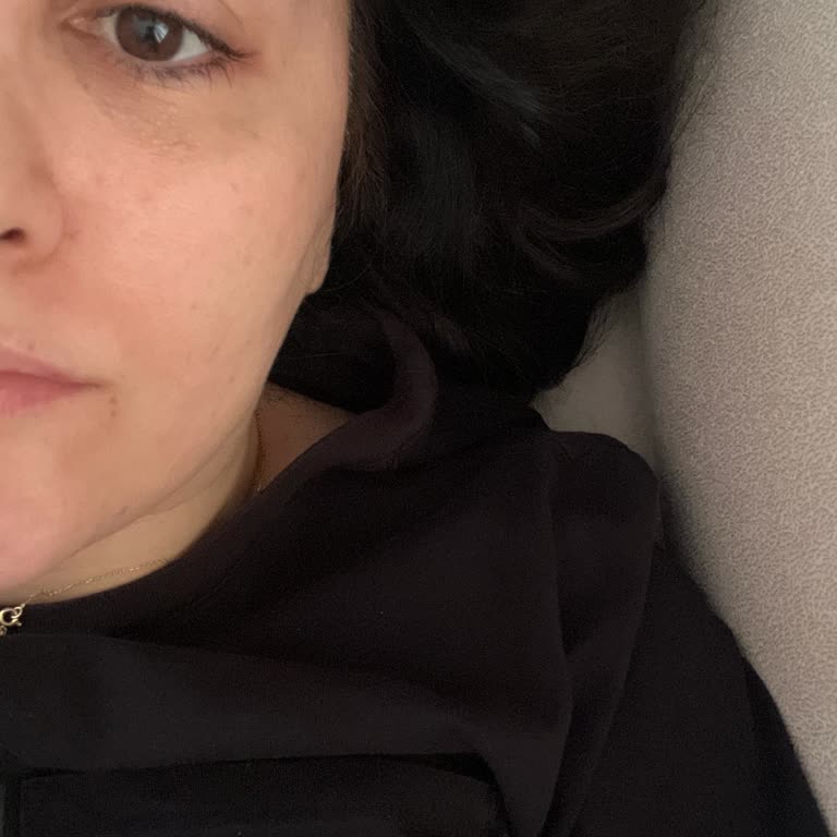 Kirpik Liftinginde Değişim Yok, Ücret İadesi Talebi