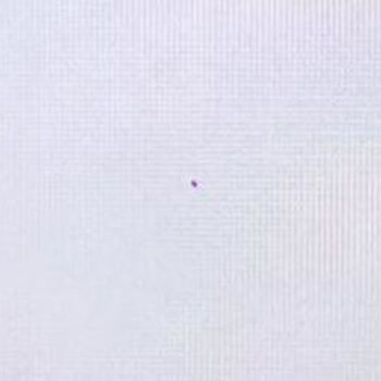 Üst Üste Ayıplı TV Ve Çözüm Merkezinde İletişim Krizi