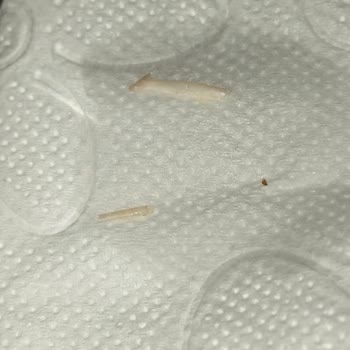 Ton Balığı Konservesinde Kılçık Bulunması Sağlık Tehlikesi Ve Güvenilirlik Sorunu