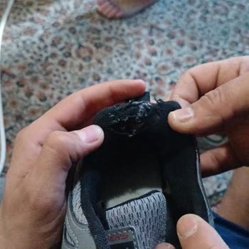 Garanti Kapsamındaki Skechers Ayakkabısı Kullanıcı Hatası Deyerek Reddedildi