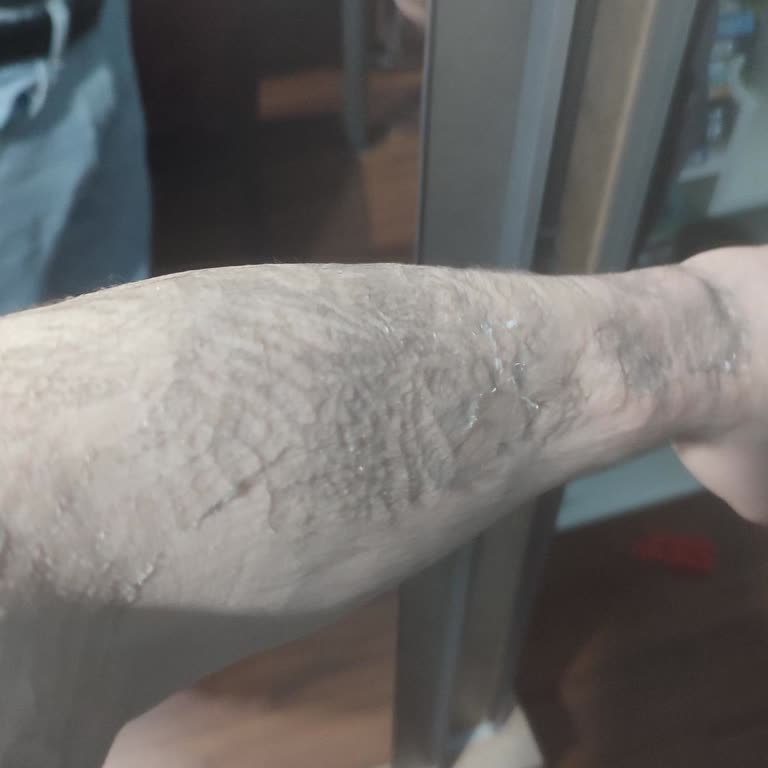 Kalitesiz Dövme Ürünü, İade Talebi Ve Satıcıdan Cevap Yok