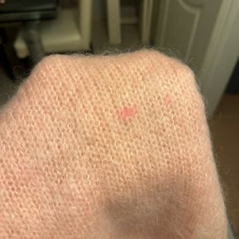 Kusurlu Ürün İadesi Ve Para İadesi Yapılmadı