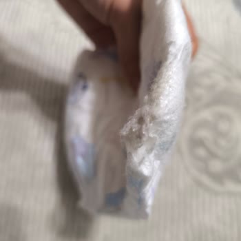 Molfix Ultra Advantage Bebek Bezinde Kesik Ve Kirli Ürün Şikayeti İade Talebi