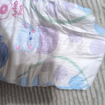 Molfix Ultra Advantage Bebek Bezinde Kesik Ve Kirli Ürün Şikayeti İade Talebi