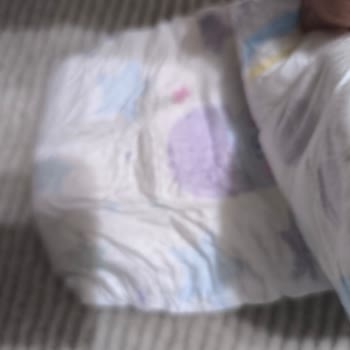 Molfix Ultra Advantage Bebek Bezinde Kesik Ve Kirli Ürün Şikayeti İade Talebi