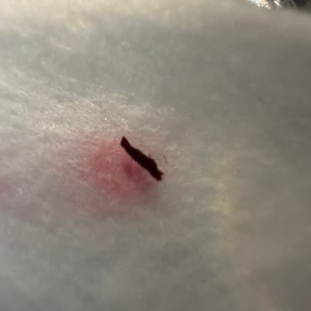 Ürün İçinde Böcek Bulundu: Hijyen Ve Güven Kırıldı