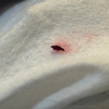 Ürün İçinde Böcek Bulundu: Hijyen Ve Güven Kırıldı