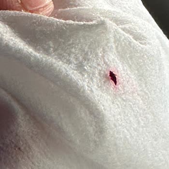 Ürün İçinde Böcek Bulundu: Hijyen Ve Güven Kırıldı