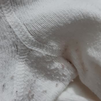 Külotlu Çorapta Deformasyon Ve E-Bebek’te Güven Kaybı