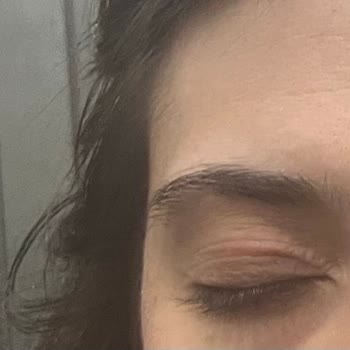 Watsons Frudia Blueberry Ürününden Yüz Ve Göz Kapaklarında Şiddetli Yanma