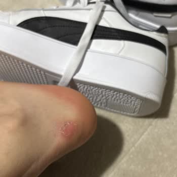 Puma Ayakkabısının Topuk Yarası Ve Boyner Mağazasının Sorumluluk Reddine Karşı İade Talebi