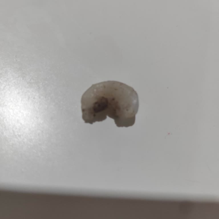 Migros Kaju Fıstığında Plastik Parça Bulunması Sağlık Endişesi Yarattı