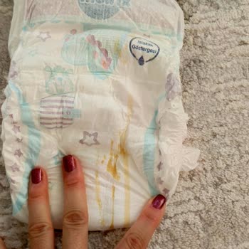 Molfix Cırtlı Bebek Bezinde Lekeli Ürün Ve Hijyen Endişesi