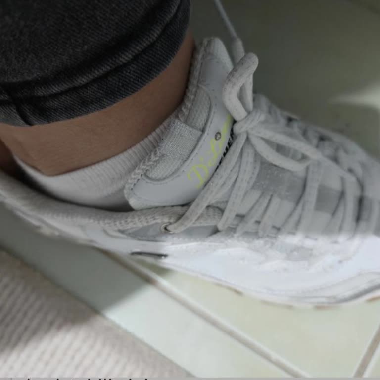 Skechers Ayakkabısının Genişleyerek Numara Değişmesi Ve İade Talebinin Reddedilmesi