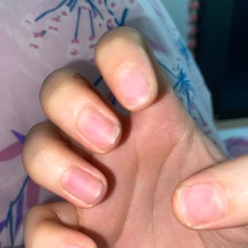 Manikür Yapılmadan Tırnak Çıkarma, Saygısız Tutum Ve Haksız Ücret Talebi