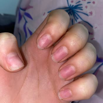 Manikür Yapılmadan Tırnak Çıkarma, Saygısız Tutum Ve Haksız Ücret Talebi