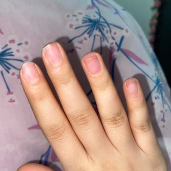 Manikür Yapılmadan Tırnak Çıkarma, Saygısız Tutum Ve Haksız Ücret Talebi