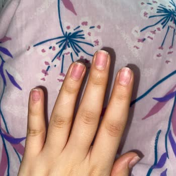 Manikür Yapılmadan Tırnak Çıkarma, Saygısız Tutum Ve Haksız Ücret Talebi