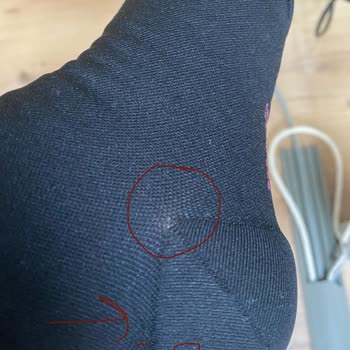 Açılan Lipödem Çorabı Ve Işık Medikal’in İlgisiz Yanıtı