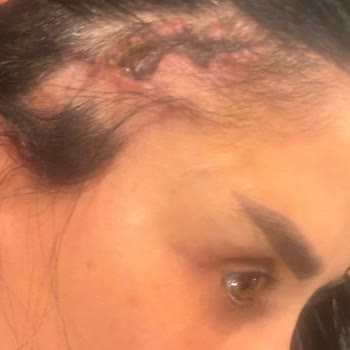 Operasyon Ücretinin İadesi Talebi Ve Geri Dönüşsüz Hizmet Şikayeti