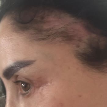 Operasyon Ücretinin İadesi Talebi Ve Geri Dönüşsüz Hizmet Şikayeti