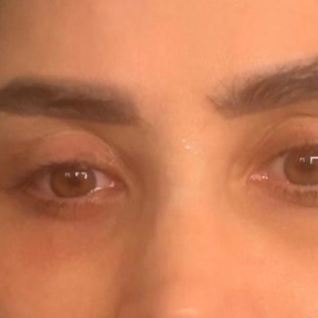 Operasyon Ücretinin İadesi Talebi Ve Geri Dönüşsüz Hizmet Şikayeti