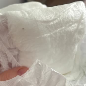 Sleepy Bebek Bezinde Yabancı Madde Ve Ele Batan His Tespit Edildi