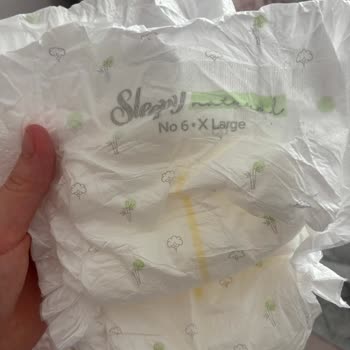 Sleepy Bebek Bezinde Yabancı Madde Ve Ele Batan His Tespit Edildi