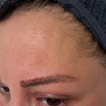 Esse Life İzmir Cildime Hasar Veren Dövme Silme Hizmetinde İade Reddi Ve Saygısız Davranış