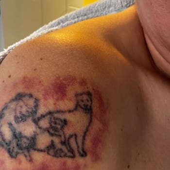 Esse Life İzmir Cildime Hasar Veren Dövme Silme Hizmetinde İade Reddi Ve Saygısız Davranış