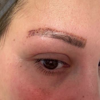 Esse Life İzmir Cildime Hasar Veren Dövme Silme Hizmetinde İade Reddi Ve Saygısız Davranış