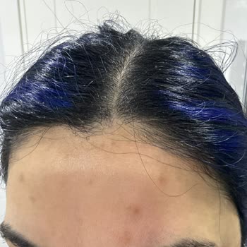 Nivea Son Kullanma Tarihi 2010 Olan Ürün Satışı Sağlık Ve Maddi Mağduriyete Neden Oldu