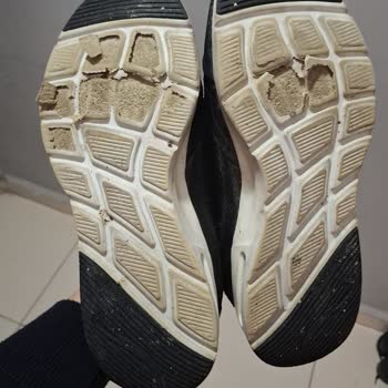 Skechers Ayakkabının Tabanı Eridi, Garanti Reddedildi