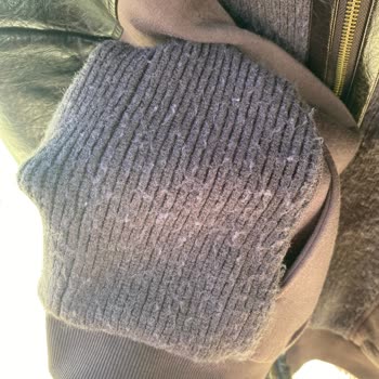 Kısa Sürede Tüylenen Ceket İçin Kullanıcı Hatası Reddi