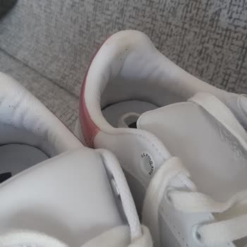 Ayakkabının Dikişleri Ayak Ağrısına Neden Oluyor, Değişim Reddi