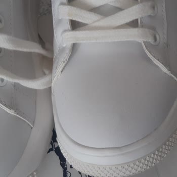 Ayakkabının Dikişleri Ayak Ağrısına Neden Oluyor, Değişim Reddi