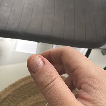 Bonita Beauty Salonunda Çabuk Bozulan Protez Tırnaklar İçin Ücret İadesi Reddi