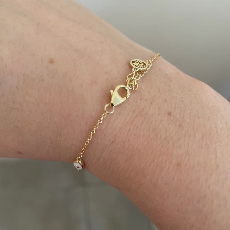 15 Gün İçinde Renk Solan Gümüş Bileklik: Güveni Sarsan Şikayet