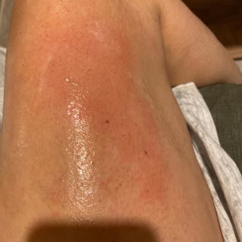 Karaca Züccaciye Tencere Setini Kullanırken Çok Ciddi Ve Tehlikeli Bir Sorun Yaşadım