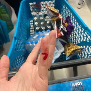 Bursa A101 Şubesinde Kırık Şişe Nedeniyle El Kesilmesi Ve Çocuk Güvenliği İhmali