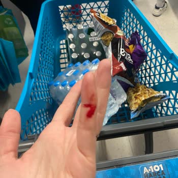 Bursa A101 Şubesinde Kırık Şişe Nedeniyle El Kesilmesi Ve Çocuk Güvenliği İhmali