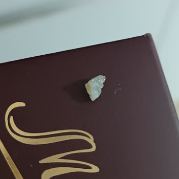 Migros Ekşi Maya Çok Tahıllı Ekmekte Taş Parçası Gıda Güvenliğinde Ciddi İhmal