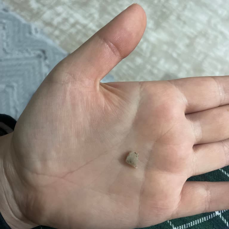 Osmanoğlu Soğuk Baklava İçinde Taş Parçası Bulundu