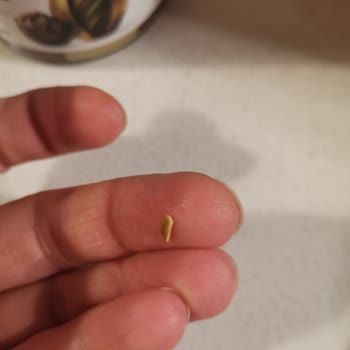 Antebella Fıstık Kremasında Kabuğu Çıkan Parça Çocuğumun Dişine Sıkıştı