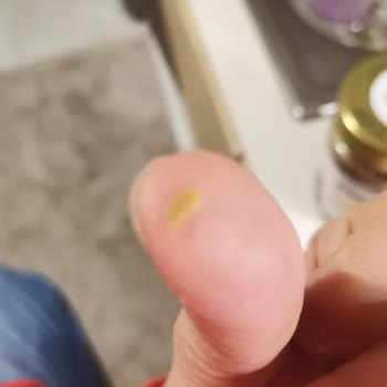 Antebella Fıstık Kremasında Kabuğu Çıkan Parça Çocuğumun Dişine Sıkıştı